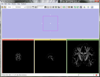 3D Slicer screenshot