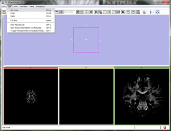 3D Slicer screenshot 2
