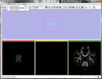 3D Slicer screenshot 3