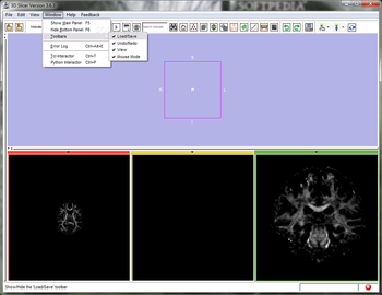 3D Slicer screenshot 4