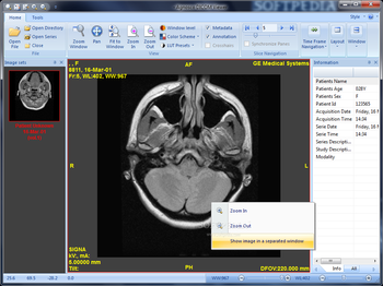 Agnosco DICOM Viewer screenshot