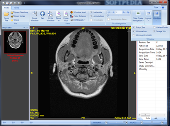 Agnosco DICOM Viewer screenshot 2