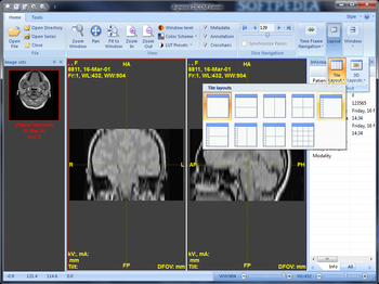 Agnosco DICOM Viewer screenshot 3