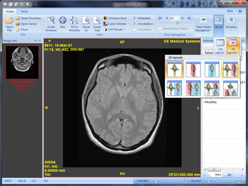 Agnosco DICOM Viewer screenshot 4