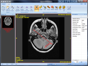 Agnosco DICOM Viewer screenshot 5