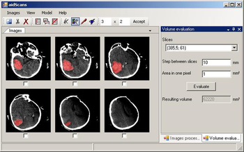 aidScans screenshot