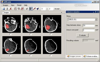 aidScans screenshot 2