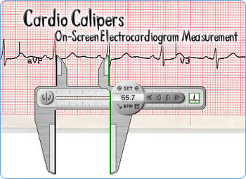 Cardio Calipers screenshot