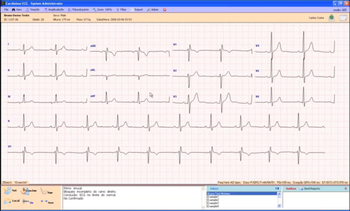 CardioBox screenshot