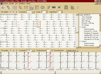 CardioVex Holter screenshot 7