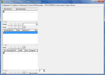 ConQuest DICOM Server screenshot 5