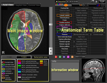 CT and MRI Interactive Atlas of Cross-Sectional Anatomy screenshot
