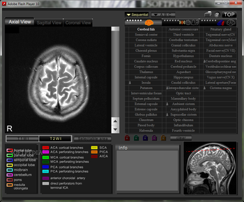 CT and MRI Interactive Atlas of Cross-Sectional Anatomy screenshot 2