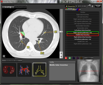 CT and MRI Interactive Atlas of Cross-Sectional Anatomy screenshot 3