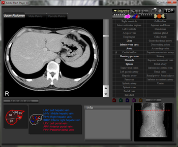CT and MRI Interactive Atlas of Cross-Sectional Anatomy screenshot 4