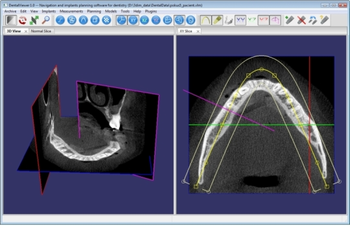 DentalViewer screenshot