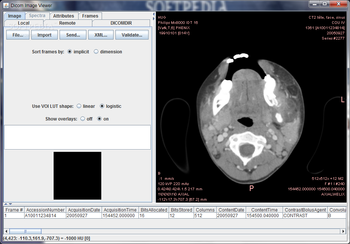 Dicom Image Viewer screenshot