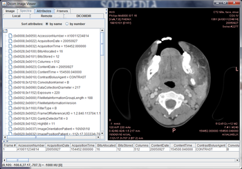 Dicom Image Viewer screenshot 2