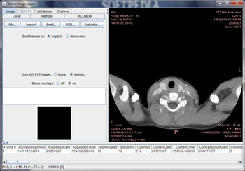 Dicom Image Viewer screenshot 3