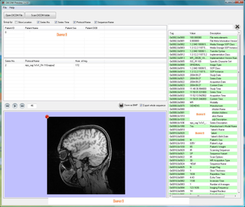 DICOM Preview screenshot