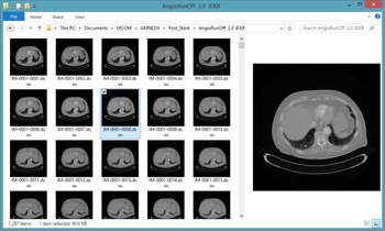 DICOM Thumbnailer screenshot