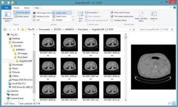 DICOM Thumbnailer screenshot 2