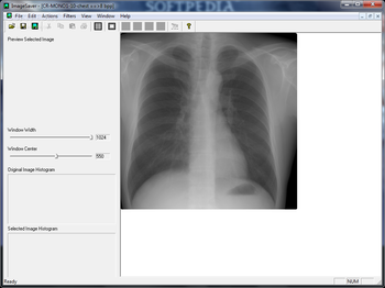 DICOM Viewer screenshot