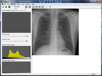 DICOM Viewer screenshot 2