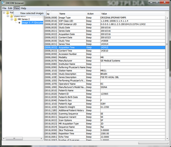 DicomBrowser screenshot 3