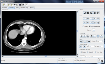 DICOMscope screenshot 2