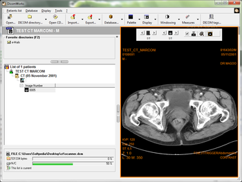 DicomWorks screenshot