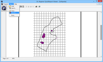 Dr. Regener QuickReport Viewer screenshot 2