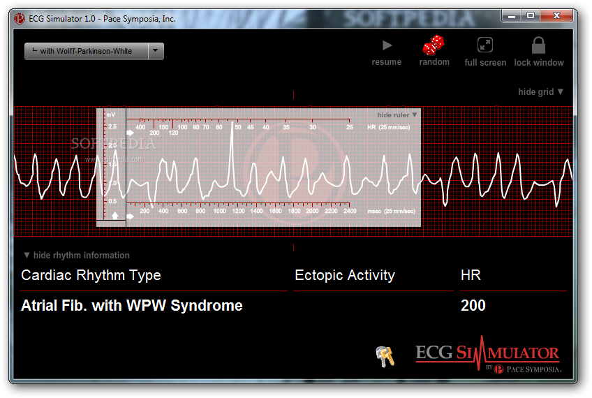 ecg software for pc free download