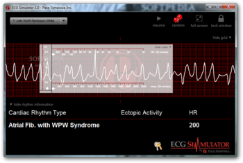 ECG Simulator screenshot 2