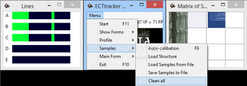 ECTtracker screenshot 4