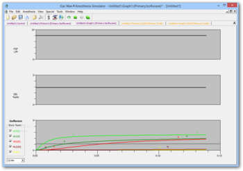 Gas Man Anesthesia Simulator screenshot 3