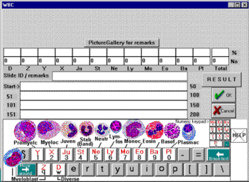 HemoDiff screenshot 2