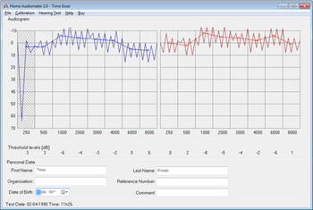 Home Audiometer Hearing Test screenshot