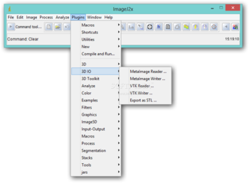 J Plugins Toolkit for ImageJ screenshot