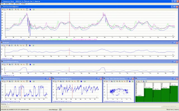 JChart2D screenshot
