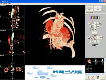 KB-Vol3D screenshot