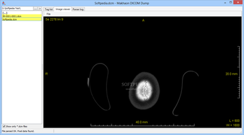 Makhaon DICOM Dump screenshot 3