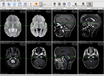 MedINRIA screenshot