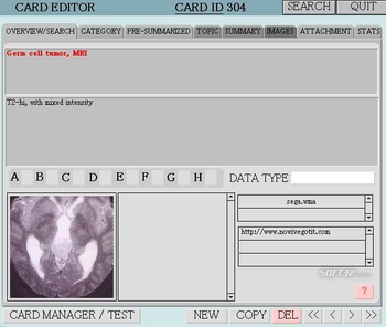 MemoryJammer screenshot