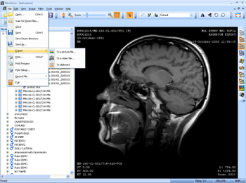 MicroDicom  screenshot