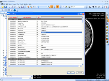 MicroDicom  screenshot 2