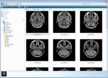 MicroDicom shell extension screenshot