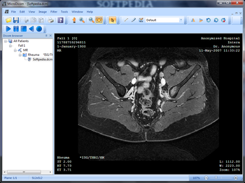 MicroDicom screenshot