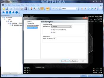 MicroDicom screenshot 13