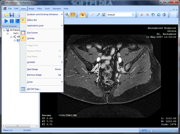 MicroDicom screenshot 2